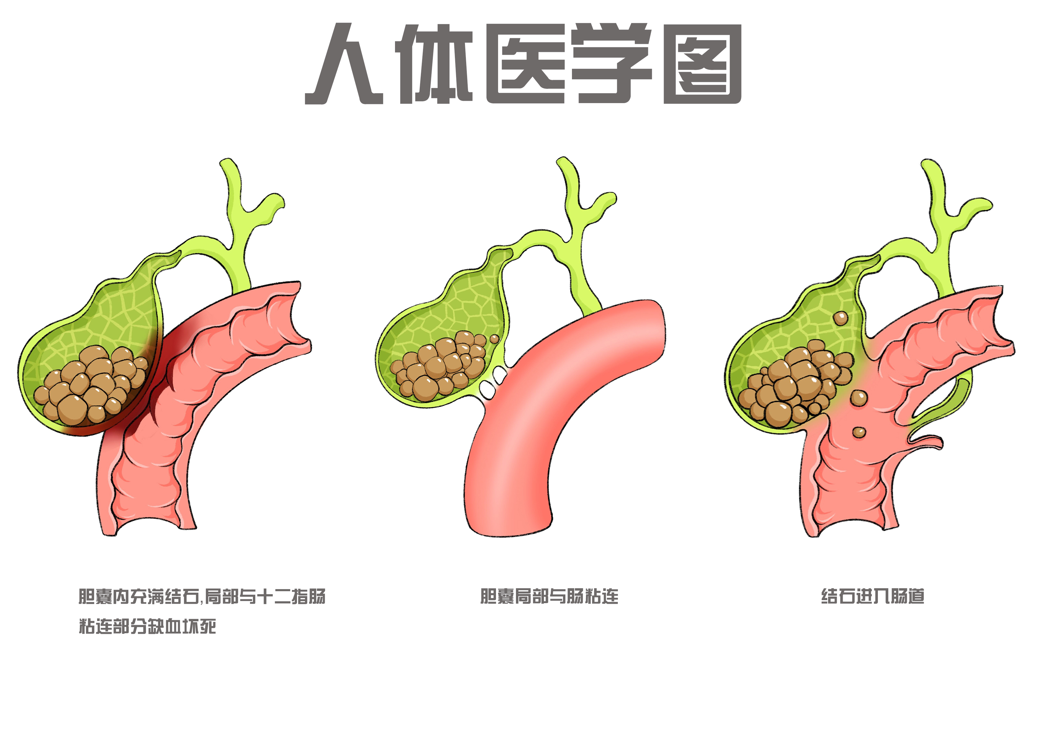 人体医学图 图1